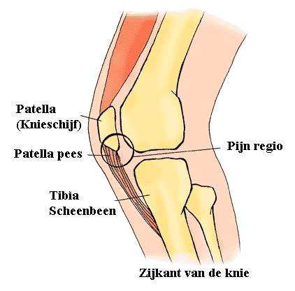 Volleyballers met springersknie gezocht